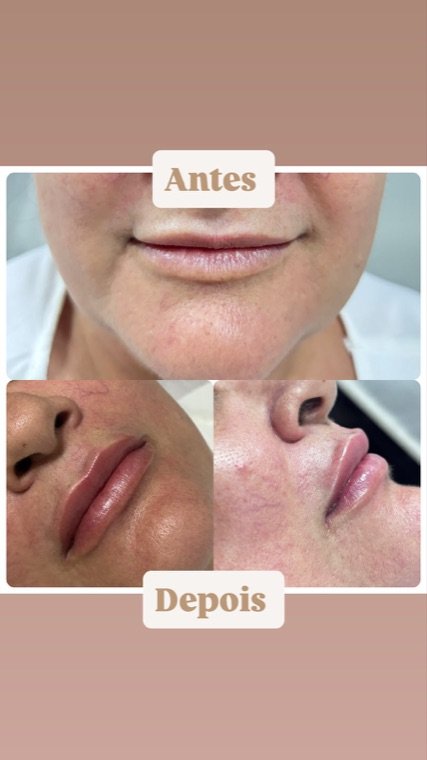 Antes e depois: resultado no Instituto Fernanda Ramalho
