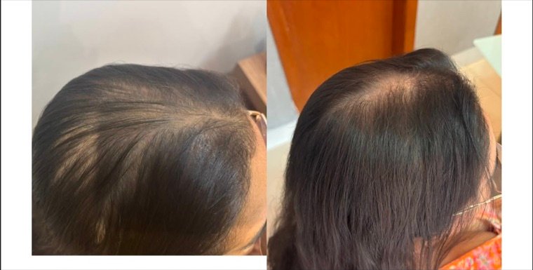 Antes e depois: resultado no Instituto Fernanda Ramalho