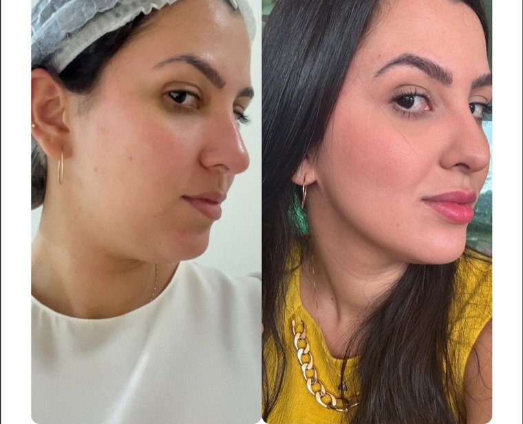 Antes e depois: resultado no Instituto Fernanda Ramalho